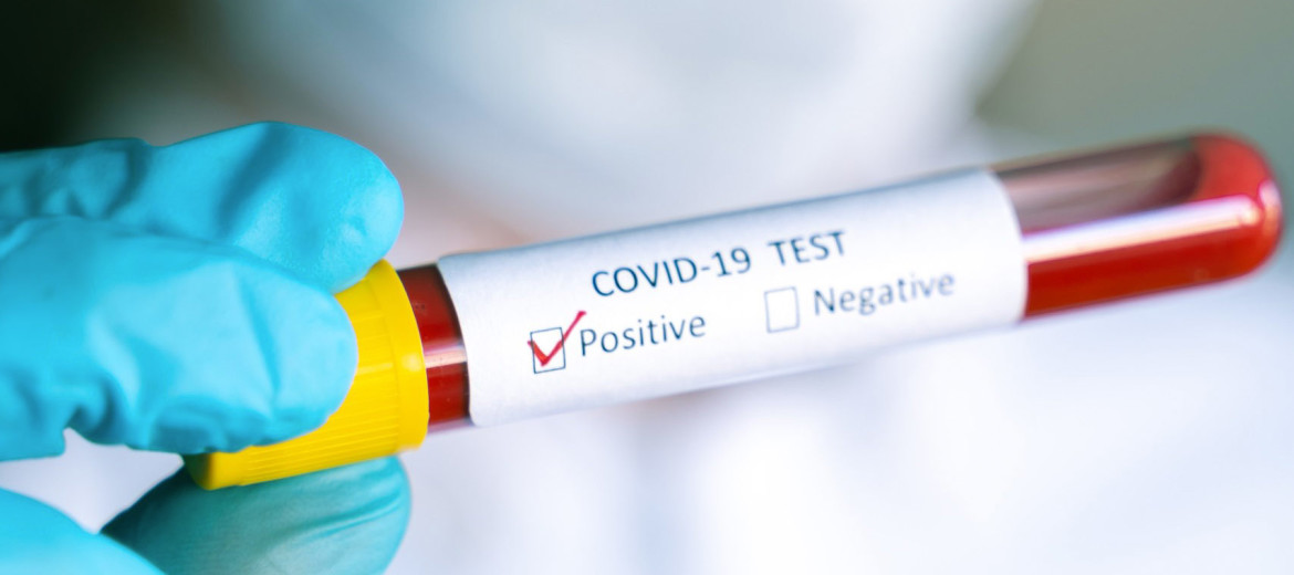 Test Coronavirus a Padova, Veneto